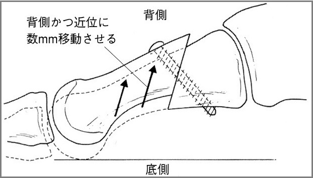 足1