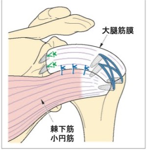 肩・肘の外科 | 大阪医科薬科大学整形外科学教室