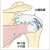 肩・肘の外科 | 大阪医科薬科大学整形外科学教室